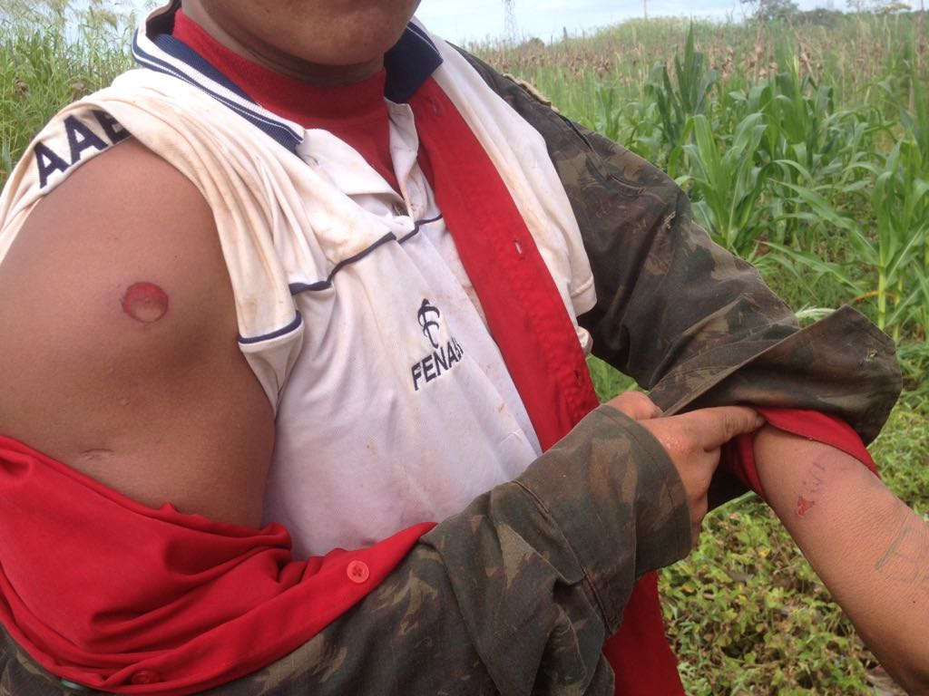 Indígena exibe marcas de bala de borracha após violenta reintegração de posse contra comunidade Terena em Dourados (MS). Foto: povo Terena